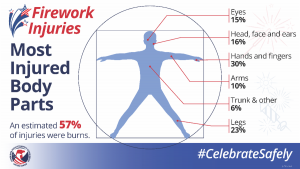 firework-injuries-2020_body-infographic